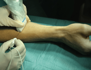 Diagnostic nerve blocks